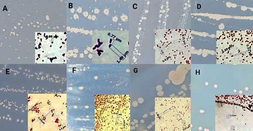 Harnessing Indigenous Bacteria toward Biological Solutions for PE, PET, and PS Plastic Waste Treatment