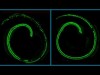 Hình chụp ốc tai chuột trên kính hiển vi đồng tiêu; Các tế bào tóc có màu xanh lục. (Hình bên trái) Hình ốc tai của chuột mang gen Tmc1 bị đột biến không được điều trị có biểu hiện mất các tế bào tóc. (Hình bên phải) Ngược lại, ốc tai của